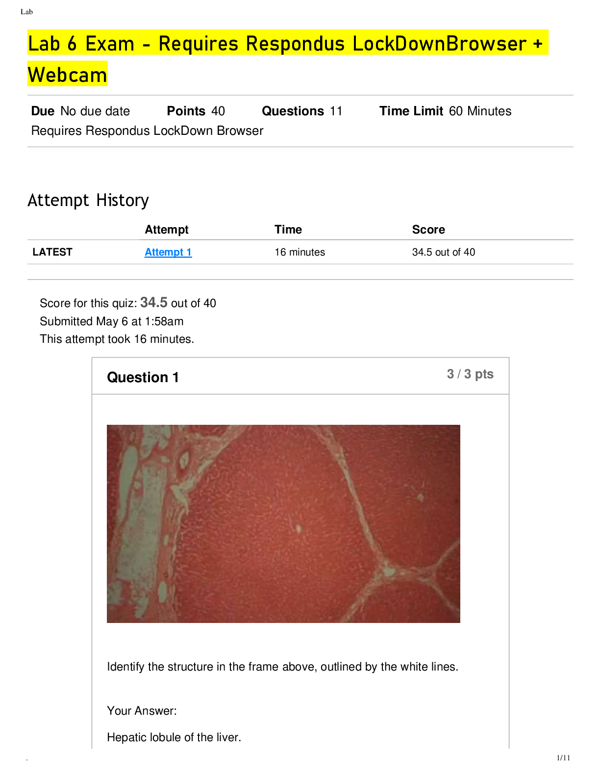 Preview of BIOD 152 AP2 Lab 6 Exam- Portage Learning